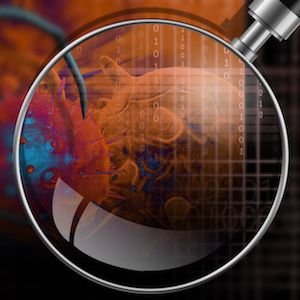 Will AI Improve Cancer Diagnosis and Treatment?