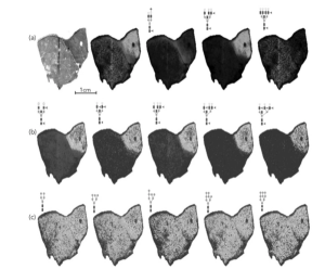 The Next Step in Targeted Drug Imaging for Oncology: Combining Laser-Induced Post-Ionization with MALDI Imaging