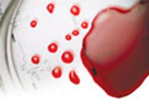 On-line Whole Blood Analysis using Microextraction by Packed Syringe (MEPS) and LC–MS–MS