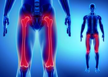 DIA LC–MS/MS Maps Proteins in Human Thighbone