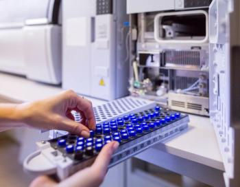 The laboratory scientist prepares samples for download to High-performance Liquid Chromatograph Mass Spectrometr. | Image Credit: © Sodel Vladyslav