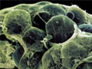 Ultrahigh-Performance Liquid Chromatography–Mass Spectrometry in Lipidomics