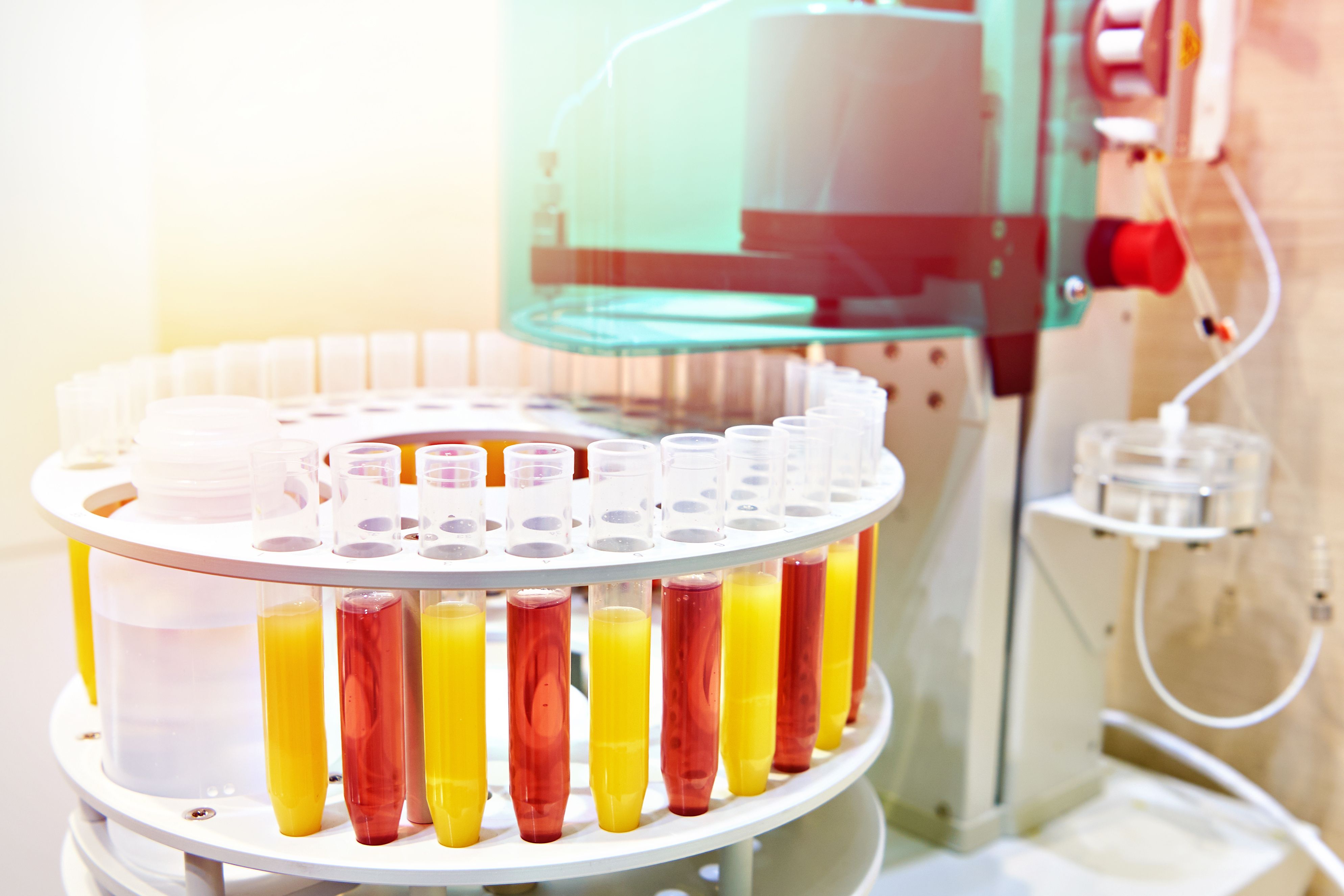 Professional laboratory sample processor pump | Image Credit: © Sergey Ryzhov - stock.adobe.com