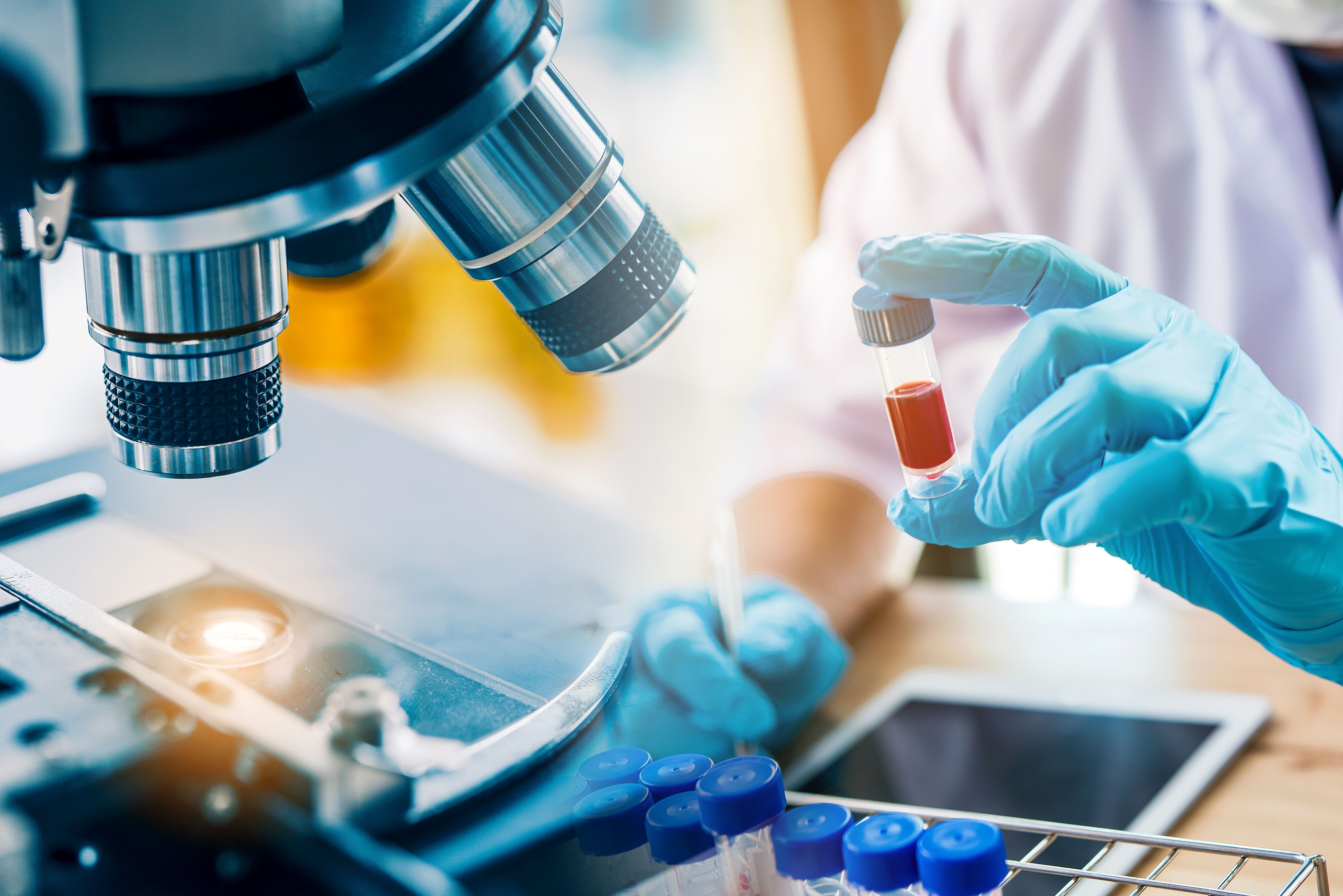 lab technician assistant analyzing a blood sample in test tube at laboratory with microscope. Medical, pharmaceutical and scientific research and development concept. | Image Credit: © totojang1977 - stock.adobe.com