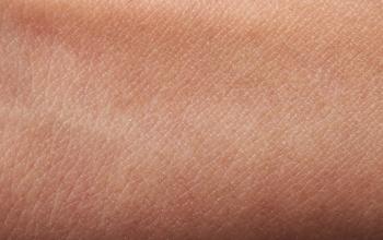Flat human skin | Image Credit: © PixieMe - stock.adobe.com