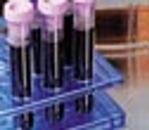 A Decade of Quantitating Cyanide in Aqueous and Blood Matrices Using Automated Cryotrapping Isotopic Dilution Static Headspace GC–MS