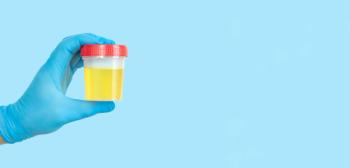 Hand holding urine sample container for medical urinalysis | Image Credit: © Дмитрий Сидор - stock.adobe.com