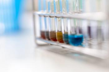 Analysis starch for study Chemical composition in laboratory. | Image Credit: © sinhyu - stock.adobe.com