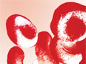 Simultaneous Headspace-GC–FID Analysis for Methanol and Ethanol in Blood, Saliva and Urine: Validation of Method and Comparison of Specimens