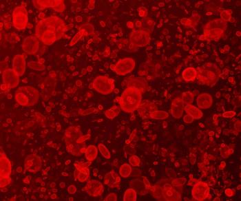 Intense cluttering of blood cells | Image Credit: © Argus - stock.adobe.com
