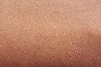 Pattern of human skin © PixieMe - stock.adobe.com