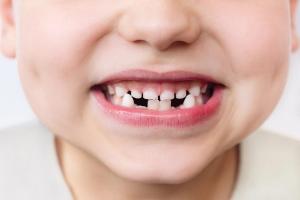GCxGC-TOF-MS Reveals Toxicants in Baby Teeth