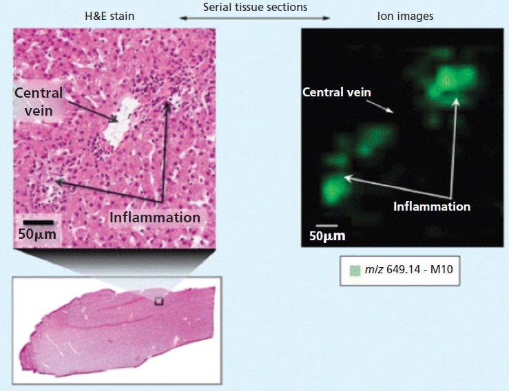 The Use of MALDI Imaging Mass Spectrometry for Interdisciplinary ...