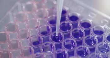 Pipette, liquid and test tube in laboratory for science experiment, chemical analysis and sample preparation. Equipment, closeup and dropper for medical research, biochemistry and solution mixing. | Image Credit: © CoetzeeRising/peopleimages.com