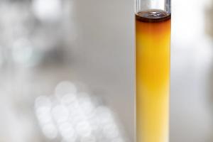 Column chromatography chemistry in the lab. | Image Credit: © sinhyu - stock.adobe.com