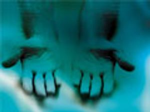 Strategies for Rapid Chiral HPLC Method Development for Pharmaceutical Analysis