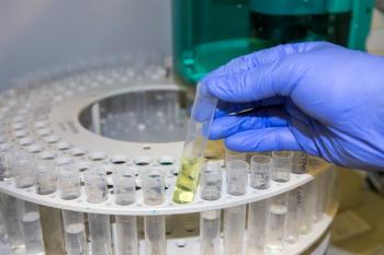 Scientist analysing CBD oil in a chemistry laboratory. Ion chromatography analysis | Image Credit: © Matt - stock.adobe.com