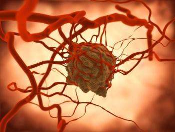 Tumor | Image Credit: © Juan Gärtner - stock.adobe.com