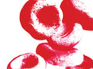 Bioanalysis Using Dried Blood Spots: The Biggest Advancement in Bioanalysis Since LC–MS-MS?