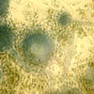 Multi-Toxin Determination in Food – The Power of "Dilute and Shoot" Approaches in LC–MS–MS