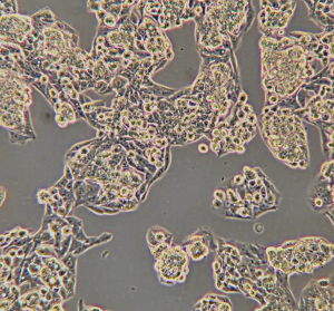 Supercritical Fluid Chromatography Coupled with Drift Time Ion Mobility Quadrupole Time-of-Flight Mass Spectrometry as a Tool for Lipid Characterization of HepG2 Cells