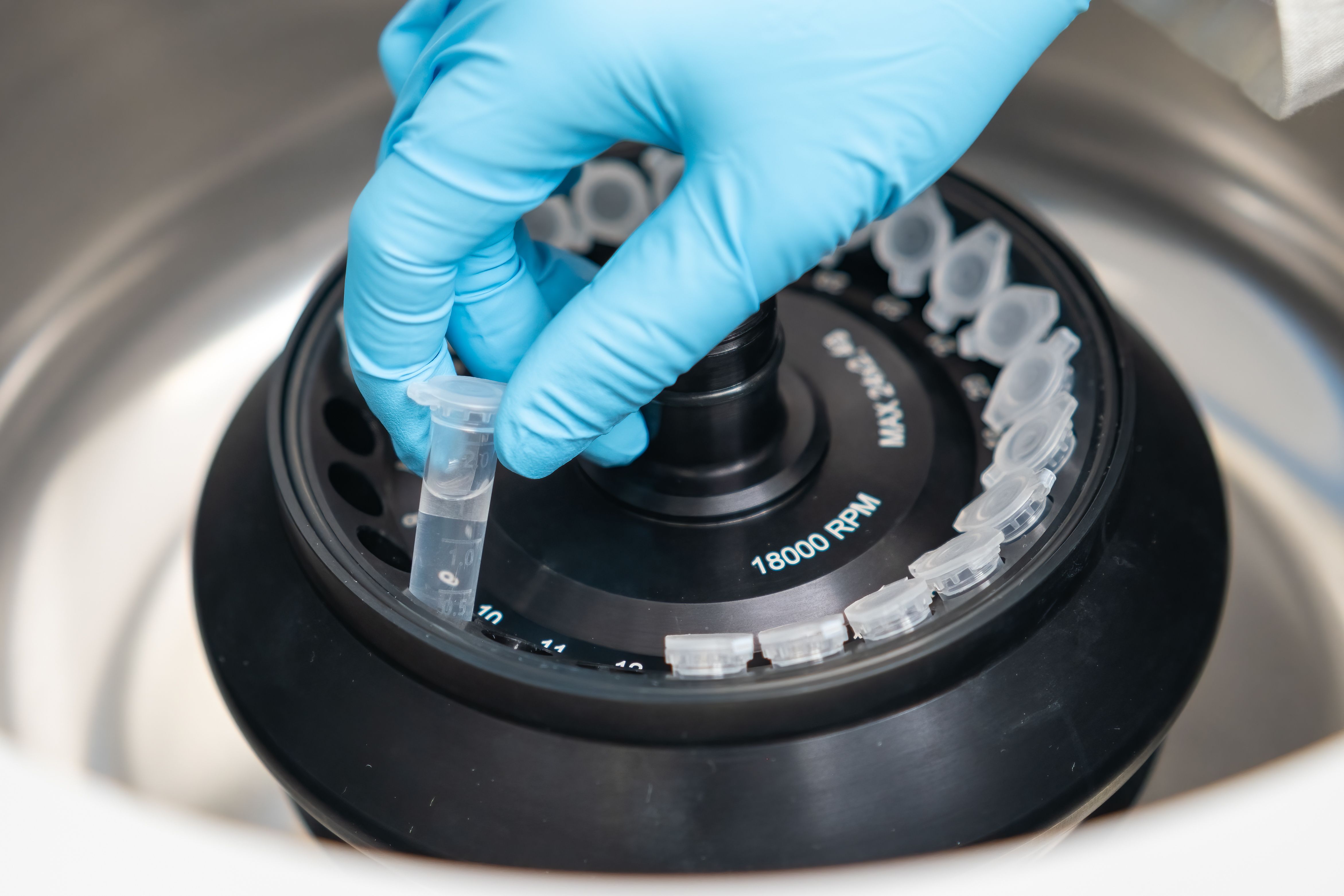 Ultralow Flow Liquid Chromatography Used to Analyze Small Biological ...
