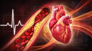 HPLC-MS Reveals Coronary Artery Disease Risk Markers