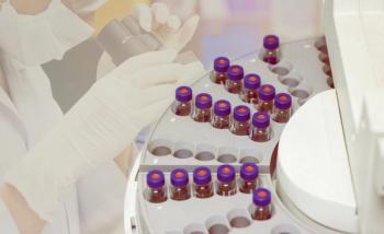 Top view of vials are arranged in the auto sampler for GC chromatography in laboratory with microscope testing background | Image Credit: © Anchalee - stock.adobe.com.