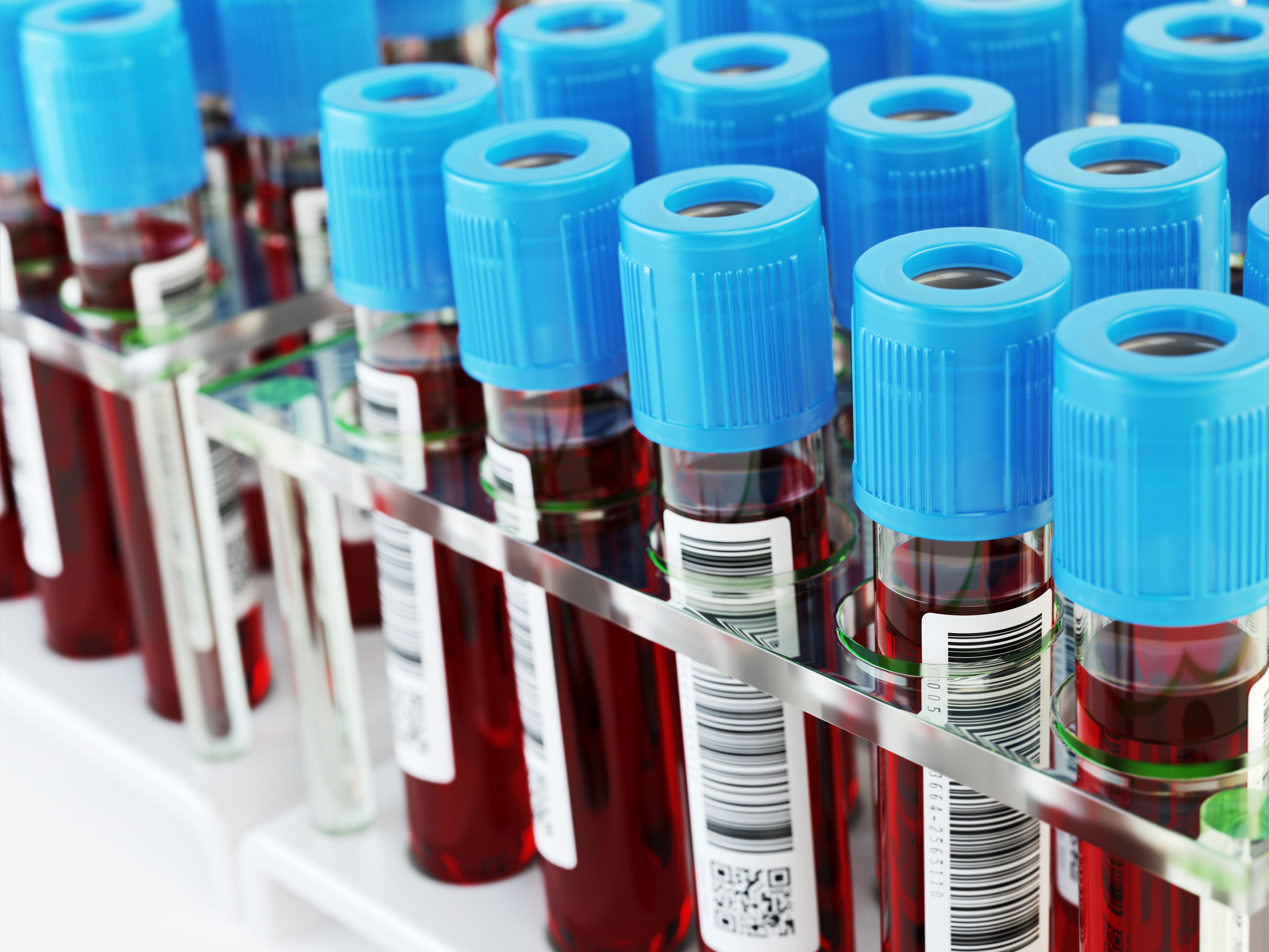 Blood test tubes. Blood samples in a rack. | Image Credit: © Maksym Yemelyanov - stock.adobe.com