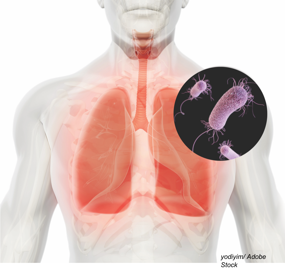 Hospital-Acquired and Ventilator-Associated Pneumonia: Highlights and ...