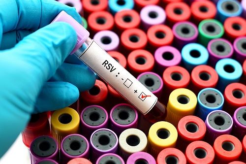 RSV blood test