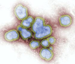 Is There Risk of Flu Outbreaks in the 2021-22 Season?