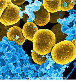 Comparing Effectiveness of Agents for MSSA Bacteremia