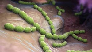 De-Escalation in the Setting of Culture-Negative Pneumonia