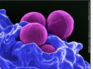 Preliminary Negative Cultures for the De-Escalation of MRSA Therapy
