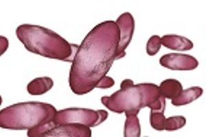 Yosemite Plague Cases Lead to Insight on Detection, Protection, and Prevention