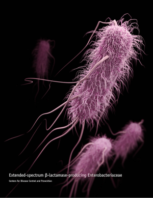 Carriage of ESBL-PE May Increase the Risk of Colorectal Surgical Site Infections