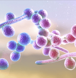 A Case of Candida Albicans Ventriculitis Secondary to E Coli Ventriculoperitoneal Shunt Infection