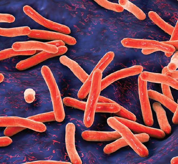 Treatment of Latent Tuberculosis in a Trice