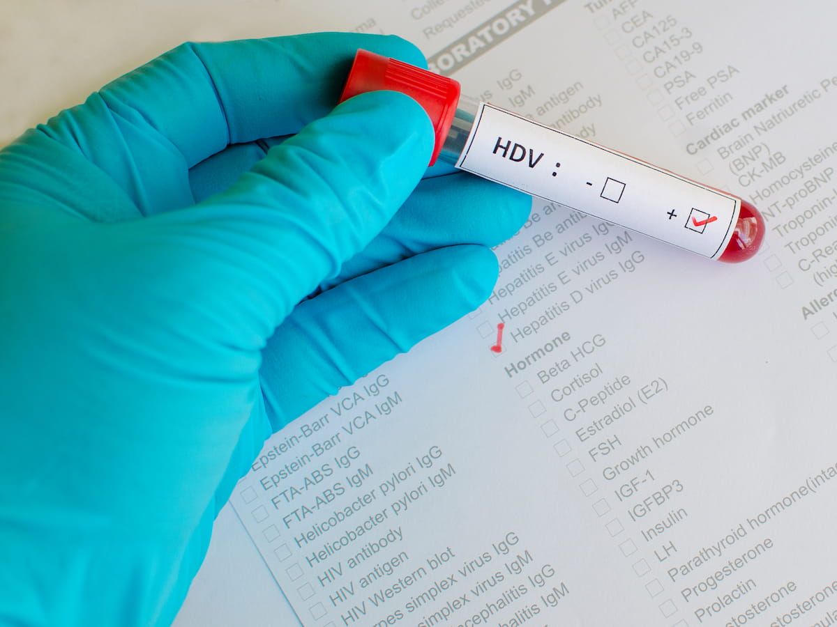hepatitis D virus