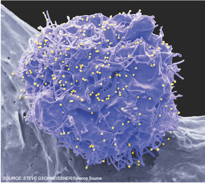 Ibalizumab Effective for MultidrugResistant HIV1 Infection