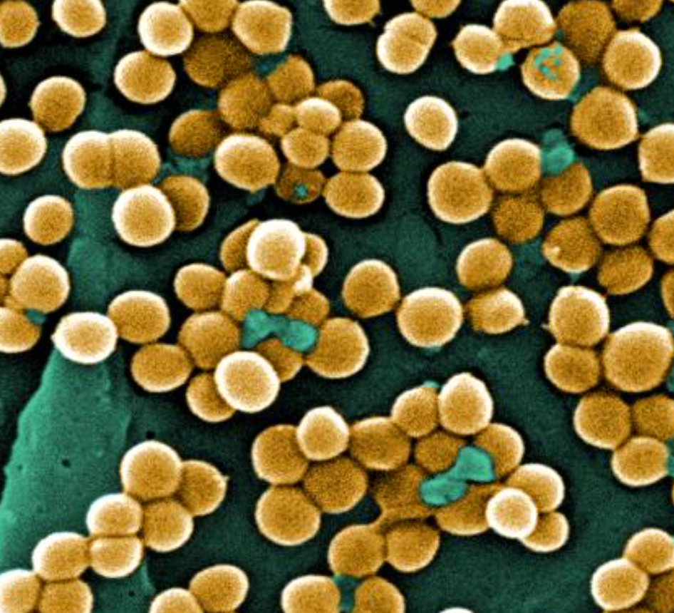 Hospitals Experiencing Inconsistent Declines in Resistant Infections ...