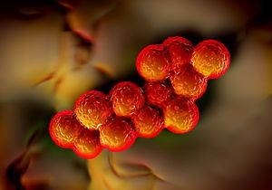 Improvement of Long-Term Outcomes of MSSA Bacteremia With Formal Infectious Disease Consults