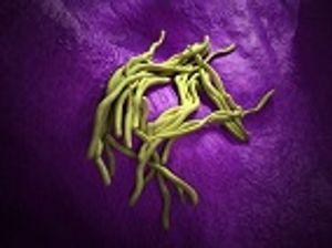 Source of Ohio Legionnaires' Outbreak Confirmed