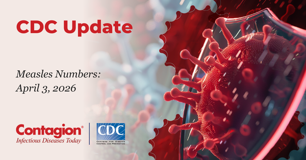 Measles Update: April 3, 2026 