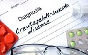 New Blood Test Could Help Diagnose CJD