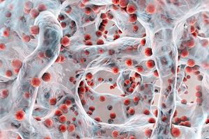 Medical Importance of Microbial Biofilms in the Management of Infectious Diseases