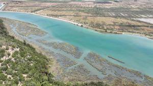 A Review of Vibrio vulnificus: Clinical Presentation and Treatment