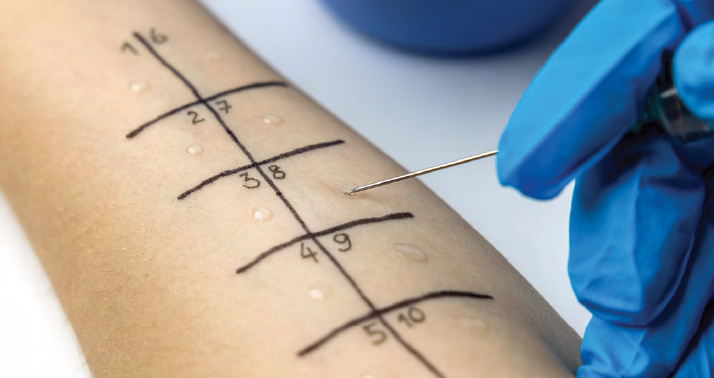 Starting an Inpatient Penicillin Skin Testing Service in 2023
