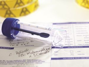 De-Escalation in Under 48 Hours Reduces 90-Day C difficile Infection Incidence 3-Fold